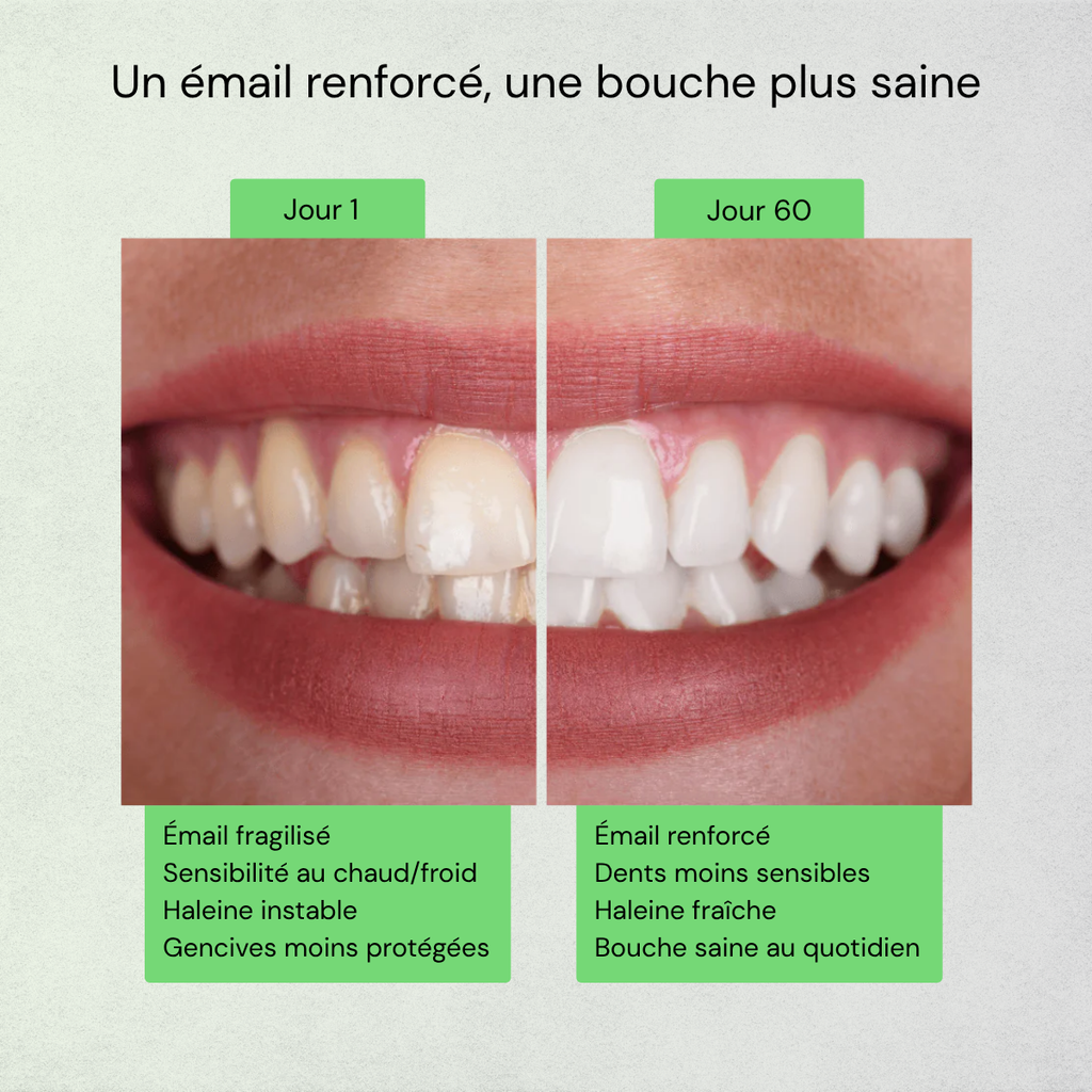 Chewing-gum Reminéralisant